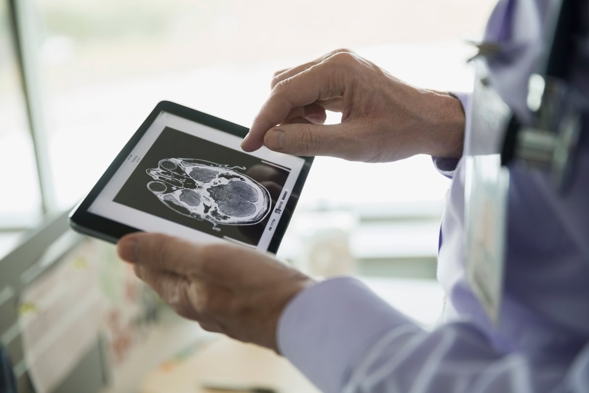 Detalle de manos de un profesional médico revisando imágenes diagnósticas en una tableta